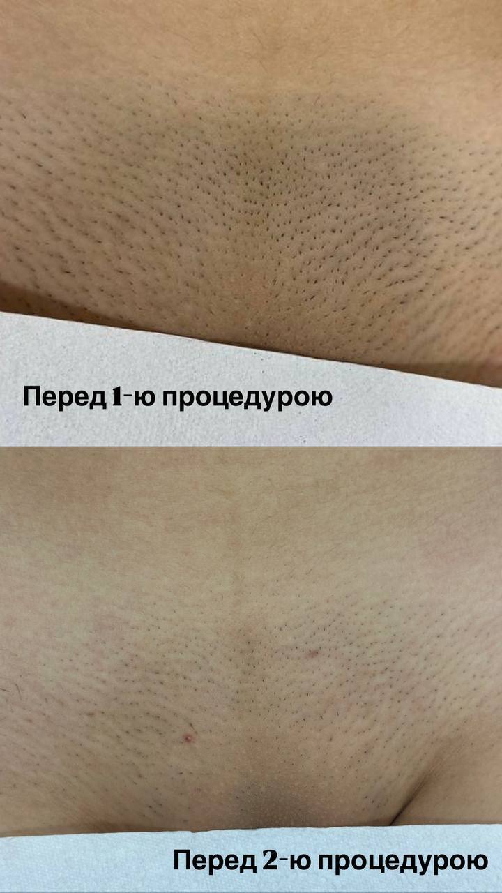 Результат 3